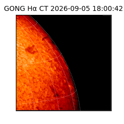 gong - 2026-09-05T18:00:42