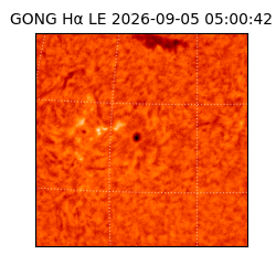 gong - 2026-09-05T05:00:42