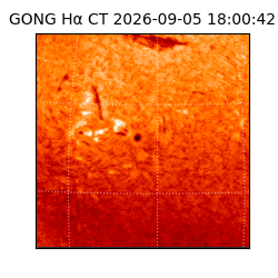 gong - 2026-09-05T18:00:42