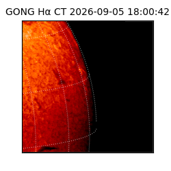 gong - 2026-09-05T18:00:42