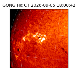 gong - 2026-09-05T18:00:42