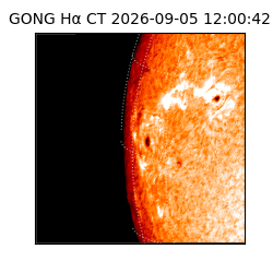 gong - 2026-09-05T12:00:42