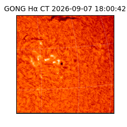 gong - 2026-09-07T18:00:42