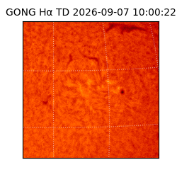 gong - 2026-09-07T10:00:22