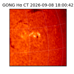 gong - 2026-09-08T18:00:42