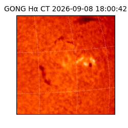 gong - 2026-09-08T18:00:42