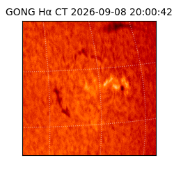 gong - 2026-09-08T20:00:42