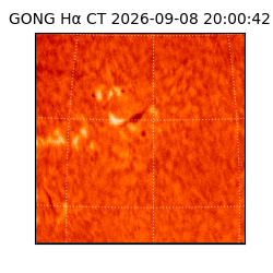 gong - 2026-09-08T20:00:42