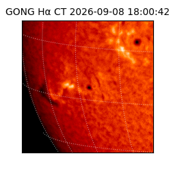gong - 2026-09-08T18:00:42