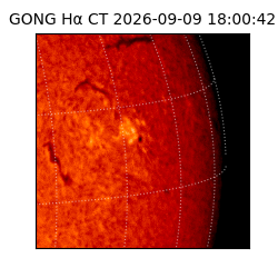 gong - 2026-09-09T18:00:42