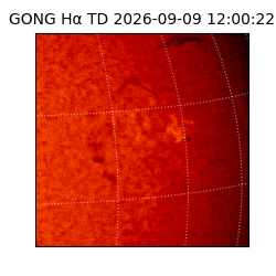 gong - 2026-09-09T12:00:22