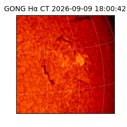 gong - 2026-09-09T18:00:42