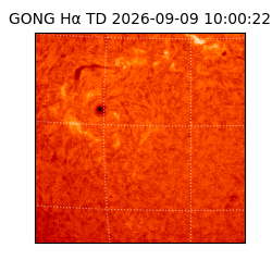 gong - 2026-09-09T10:00:22