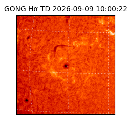 gong - 2026-09-09T10:00:22