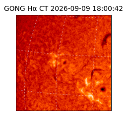 gong - 2026-09-09T18:00:42