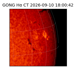 gong - 2026-09-10T18:00:42