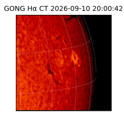 gong - 2026-09-10T20:00:42