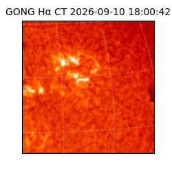 gong - 2026-09-10T18:00:42