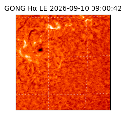 gong - 2026-09-10T09:00:42