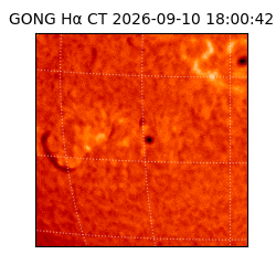gong - 2026-09-10T18:00:42