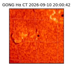 gong - 2026-09-10T20:00:42