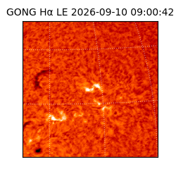 gong - 2026-09-10T09:00:42