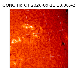 gong - 2026-09-11T18:00:42