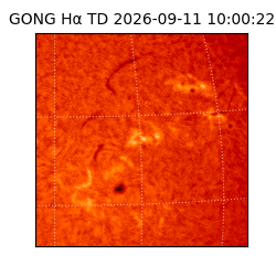 gong - 2026-09-11T10:00:22