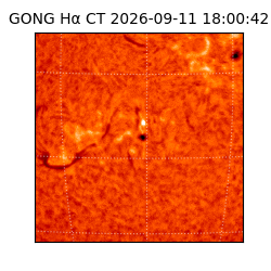 gong - 2026-09-11T18:00:42