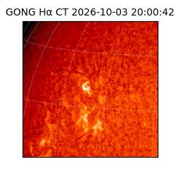 gong - 2026-10-03T20:00:42